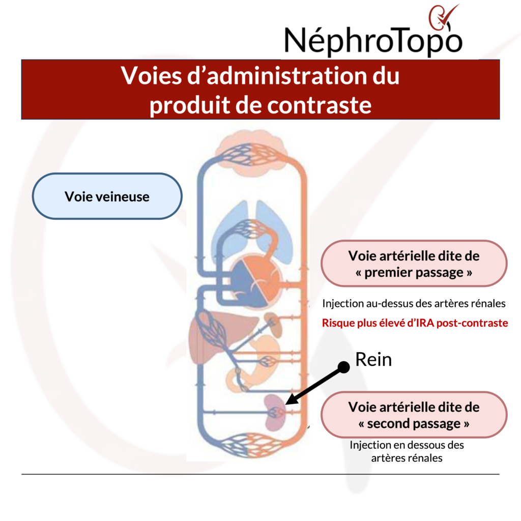 injection-ira-post-contraste-nephrotopo
